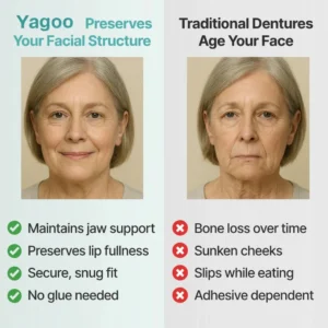 Yagoo™ Medical Full Denture with Strong Suction image Yagoo™ Medical Full Denture with Strong Suction