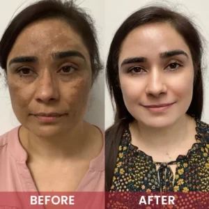 LIMETOW® Alpha-Arbutin Whitening Essence