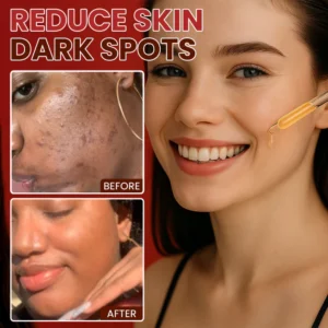 LIMETOW® Dark Spots Essence