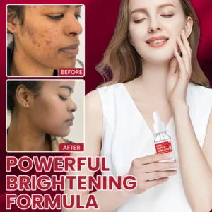 LIMETOW® Alpha-Arbutin Whitening Essence