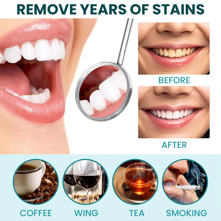 LIMETOW™ Instant Teeth Whitening Paint image LIMETOW™ Instant Teeth Whitening Paint - Image 9