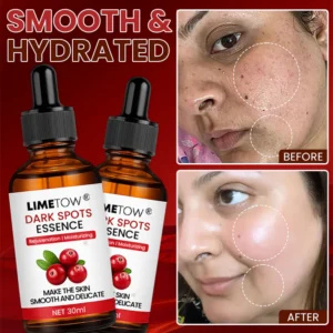 LIMETOW® Dark Spots Essence