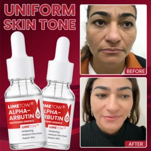LIMETOW® Alpha-Arbutin Whitening Essence