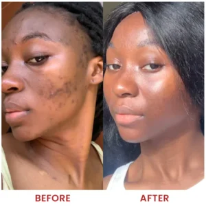 LIMETOW® Dark Spots Essence