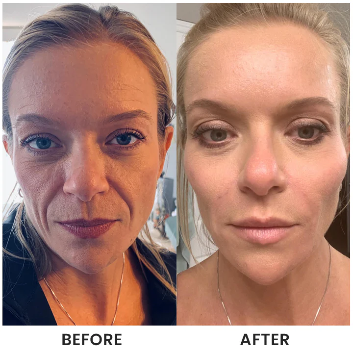 LIMETOW® Instant Face Tightener Cream