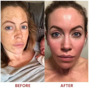 LIMETOW® Dark Spots Essence