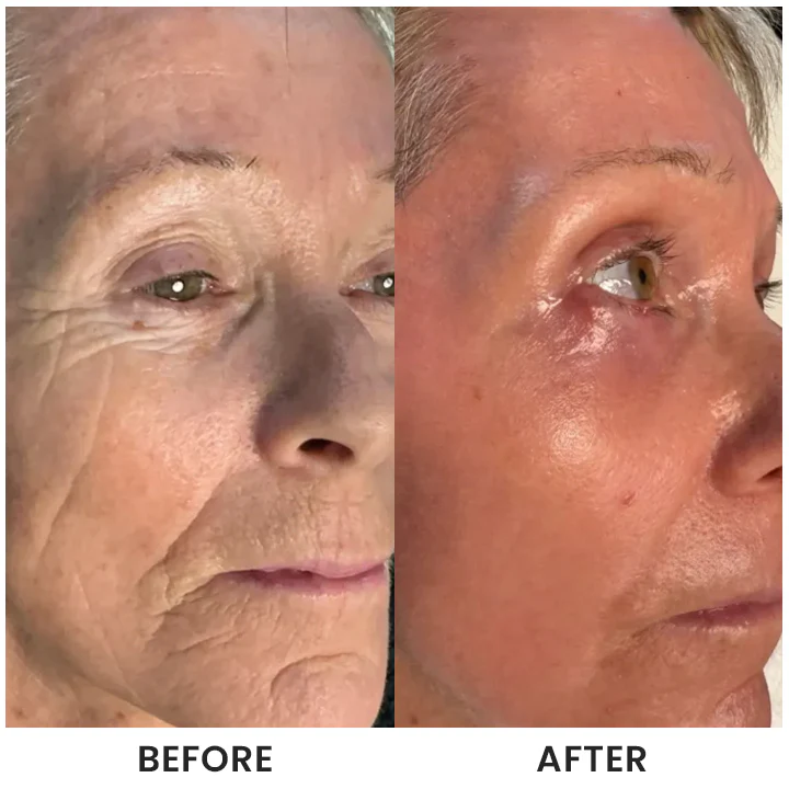 LIMETOW® Instant Face Tightener Cream