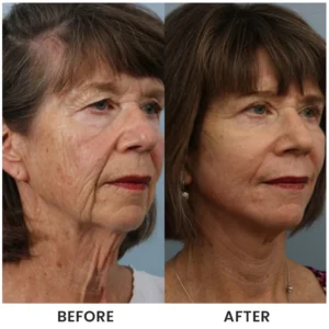 LIMETOW® Instant Face Tightener Cream