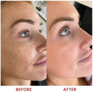 LIMETOW® Dark Spots Essence