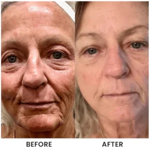 LIMETOW® Instant Face Tightener Cream