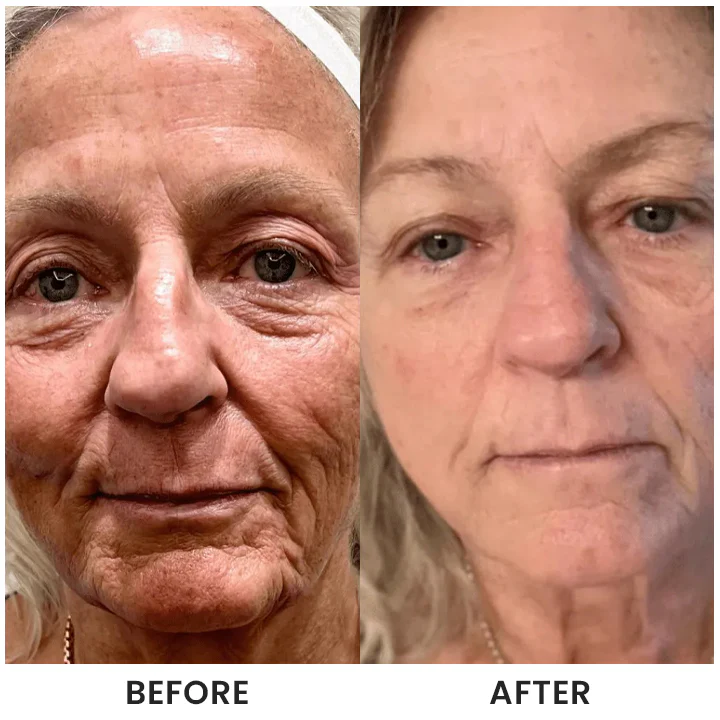 LIMETOW® Instant Face Tightener Cream - Image 12