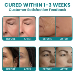 LIMETOW®Dual Action Real Deep Collagen Sheets