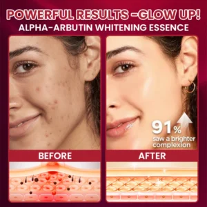 LIMETOW® Alpha-Arbutin Whitening Essence