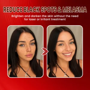 LIMETOW® Dark Spots Essence