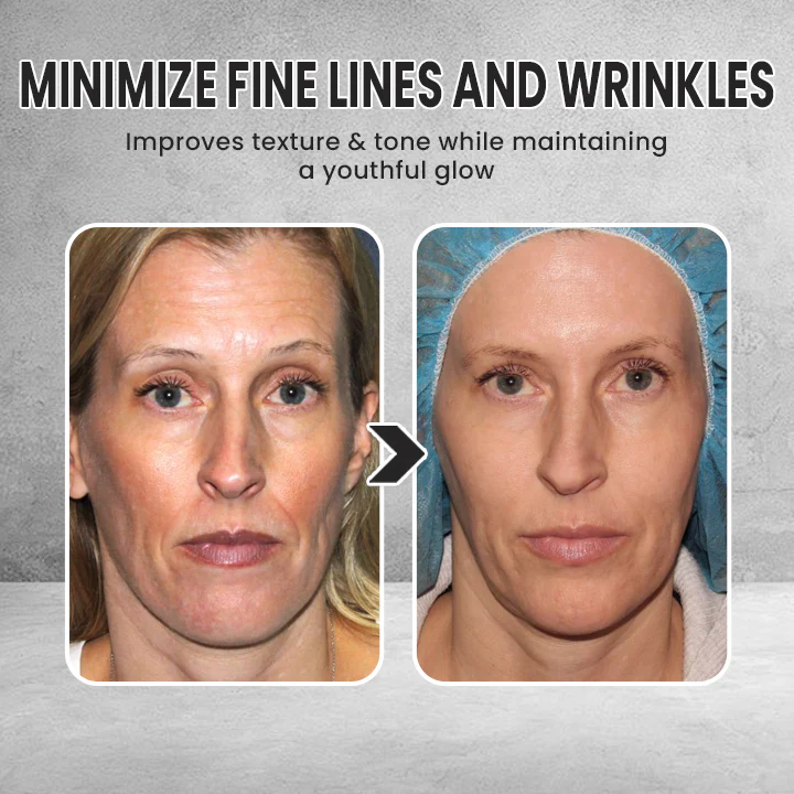 LIMETOW® Instant Face Tightener Cream