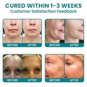 LIMETOW®Dual Action Real Deep Collagen Sheets