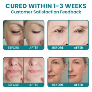 LIMETOW®Dual Action Real Deep Collagen Sheets