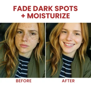 LIMETOW® Dark Spots Essence