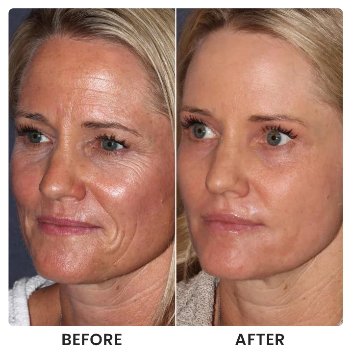 LIMETOW® Instant Face Tightener Cream