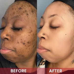 LIMETOW® Alpha-Arbutin Whitening Essence