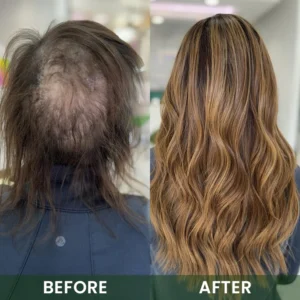 LIMETOW® Hair Boost Spray