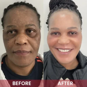 LIMETOW® Alpha-Arbutin Whitening Essence