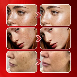 LIMETOW® Dark Spots Essence