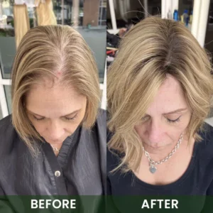 LIMETOW® Hair Boost Spray