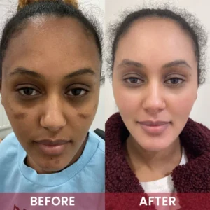 LIMETOW® Alpha-Arbutin Whitening Essence