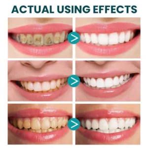 LIMETOW™ Instant Teeth Whitening Paint image LIMETOW™ Instant Teeth Whitening Paint