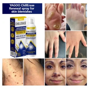 Yagoo® ChillErase Renewal Spray for Skin Impurities image Yagoo® ChillErase Renewal Spray for Skin Impurities