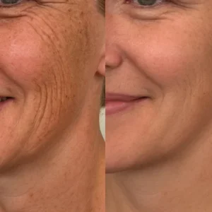 LIMETOW®Dual Action Real Deep Collagen Sheets