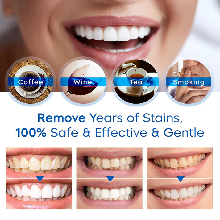 LIMETOW™ Teeth Whitening Essence image LIMETOW™ Teeth Whitening Essence