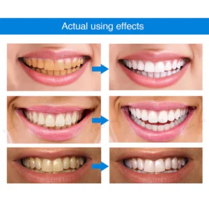 LIMETOW™ Teeth Whitening Essence image LIMETOW™ Teeth Whitening Essence