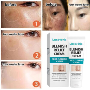 Luxevéria blemish relief cream Why the Dermatologist’s “Skincare Gospel” Is Failing image Luxevéria blemish relief cream