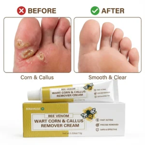 ZOVAMUSE Bee Venom Wart Corn & Callus Remover Cream
