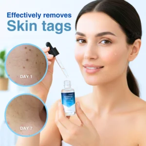 Cvreoz® Advanced Skin Tag & Wart Removal Essence image Cvreoz® Advanced Skin Tag & Wart Removal Essence
