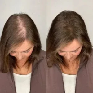 ROSOPL® Rosemary Hydrolyzed Keratin Shampoo