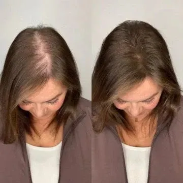 ROSOPL® Rosemary Hydrolyzed Keratin Shampoo