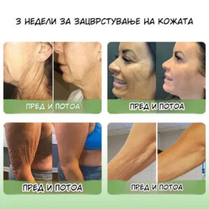 LEFUN® Skin Rejuvenation and Tightening Oil