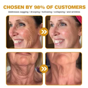 Rekulo™ Botox Bee Venom Wrinkle Removal Cream