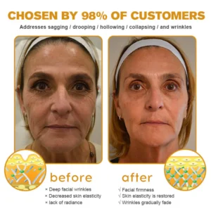 Rekulo™ Botox Bee Venom Wrinkle Removal Cream