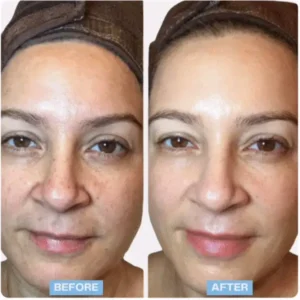 Kartzoa 7-in-1 Ems Led Facial Sculptor image Kartzoa 7-in-1 Ems Led Facial Sculptor