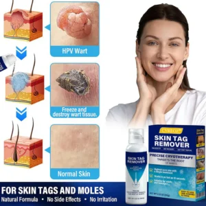 CVREOZ® TagRecede Cryo Treatment Spray image CVREOZ® TagRecede Cryo Treatment Spray