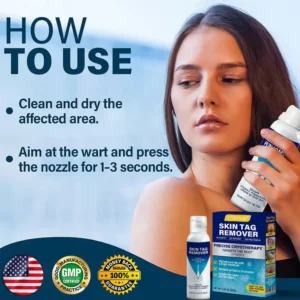 CVREOZ® TagRecede Cryo Treatment Spray image CVREOZ® TagRecede Cryo Treatment Spray