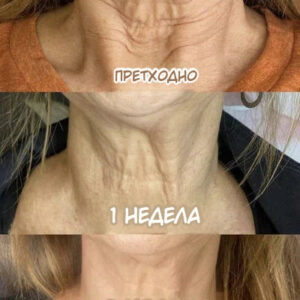 LEFUN® Skin Rejuvenation and Tightening Oil