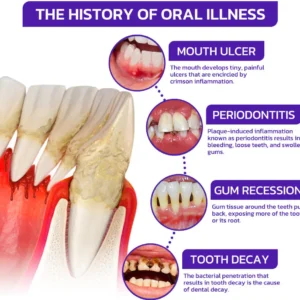 Alisanda® Bee Venom Dental Treatment Toothpaste image Alisanda® Bee Venom Dental Treatment Toothpaste