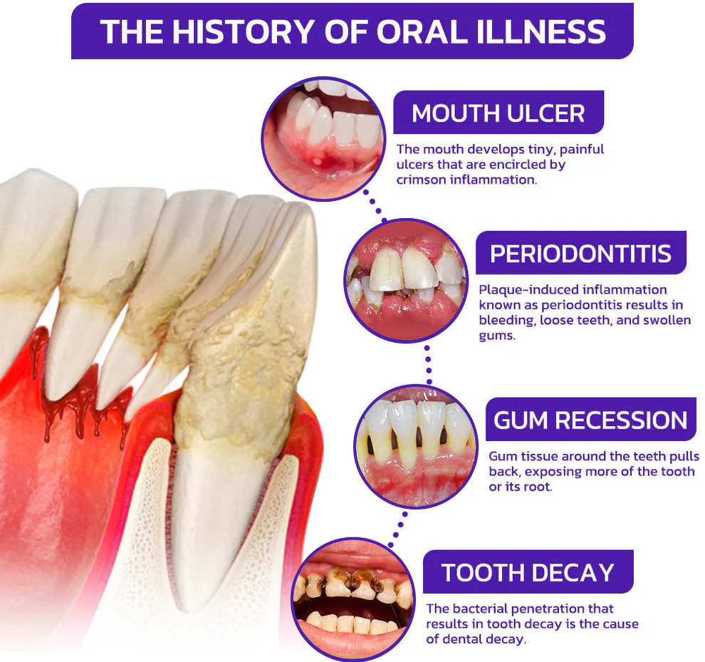 Alisanda® Bee Venom Dental Treatment Toothpaste image Alisanda® Bee Venom Dental Treatment Toothpaste