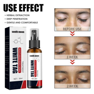 Kolmax™ Vitiligo Relief Spray