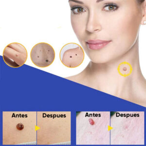 FORMU CLEAR™ Painless Wart-Free Skin! 216 Patches!